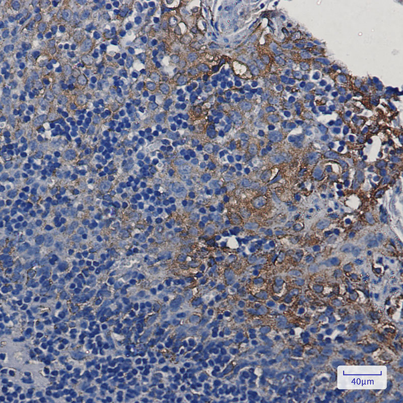 STING Rabbit mAb